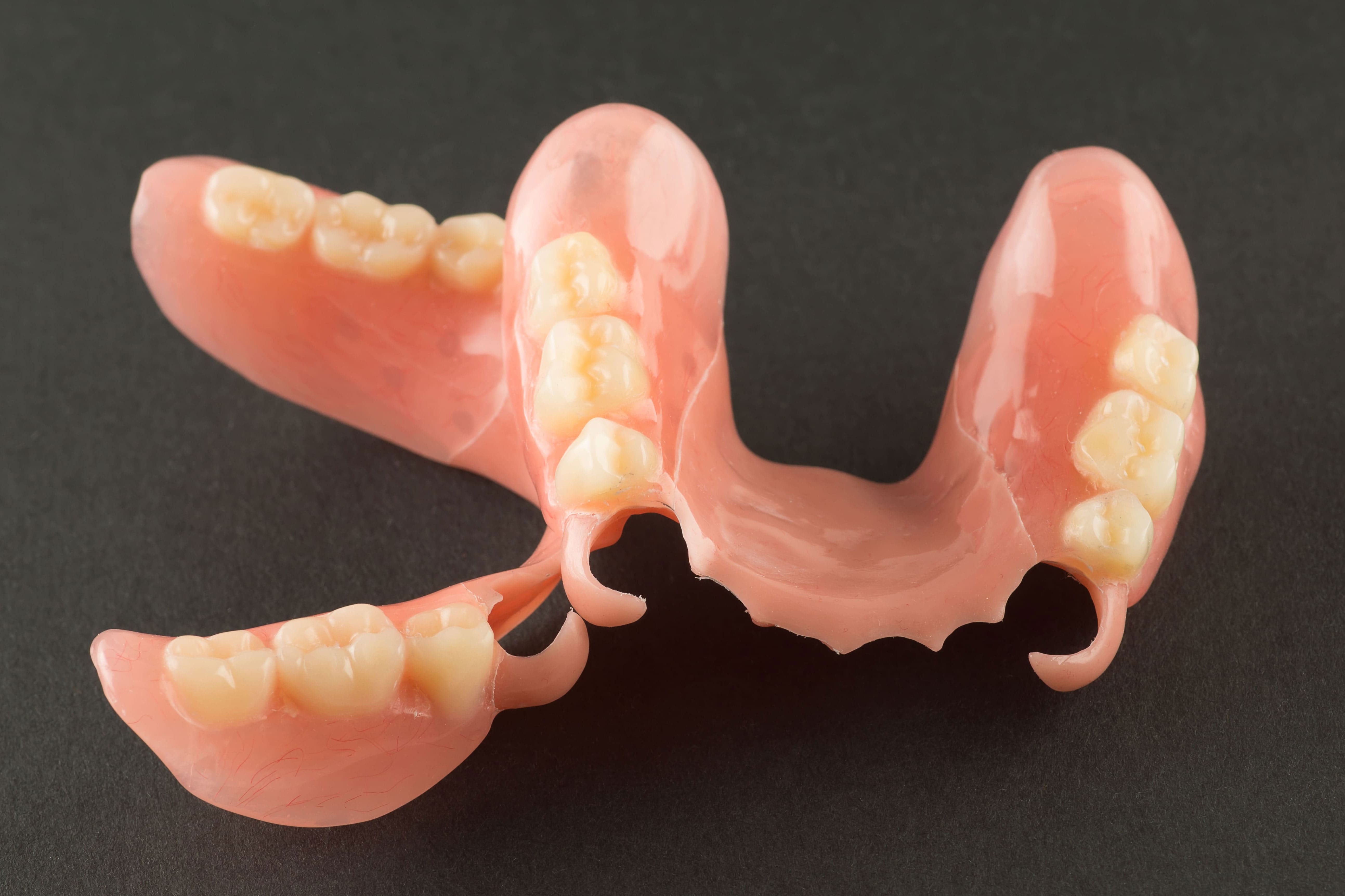 ノンクラスプデンチャー（自費診療）