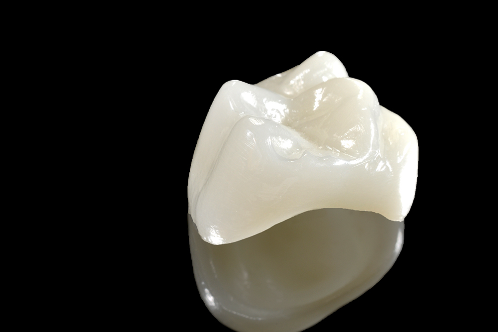 セラミック治療