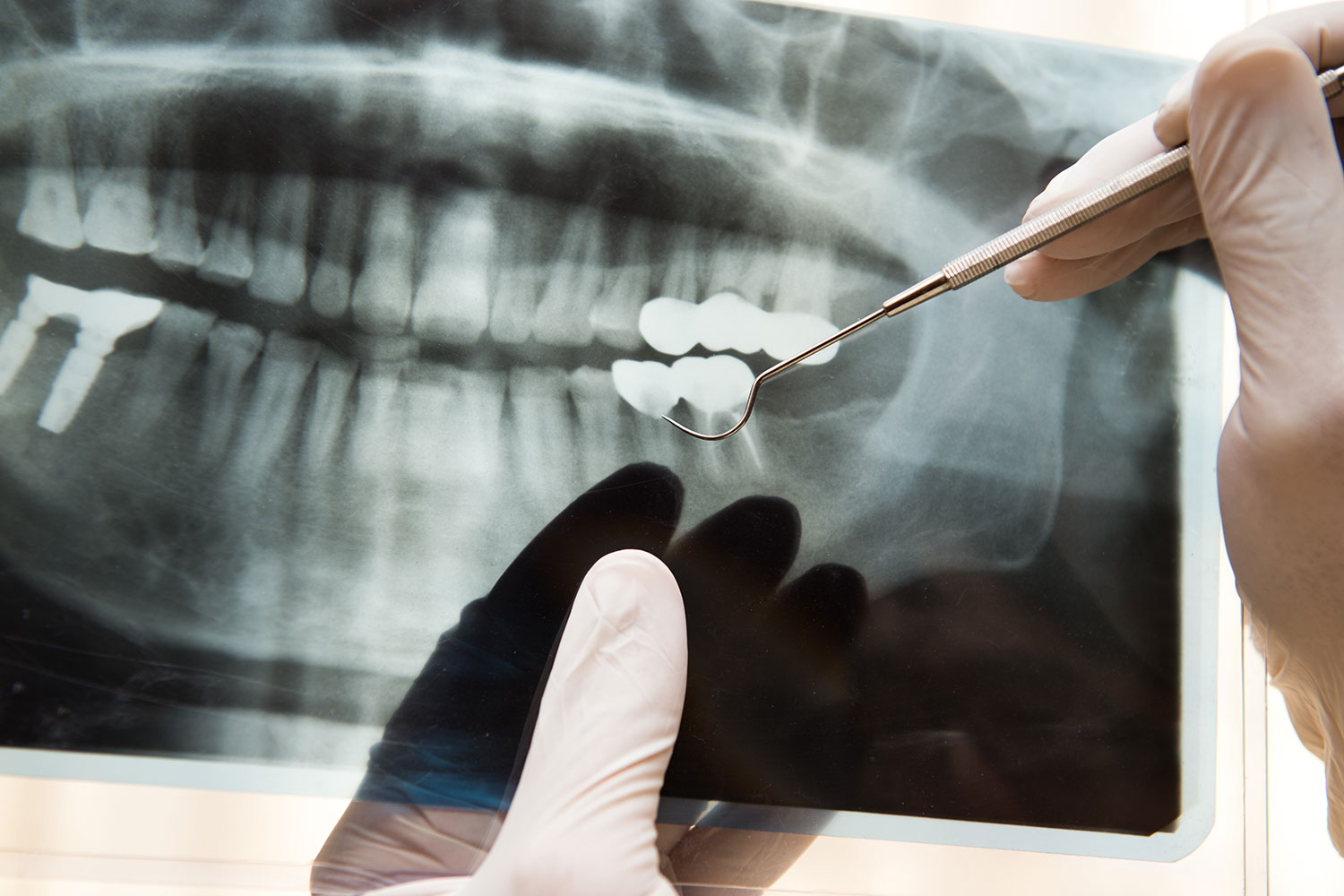 コンピューターシミュレーションで安全に